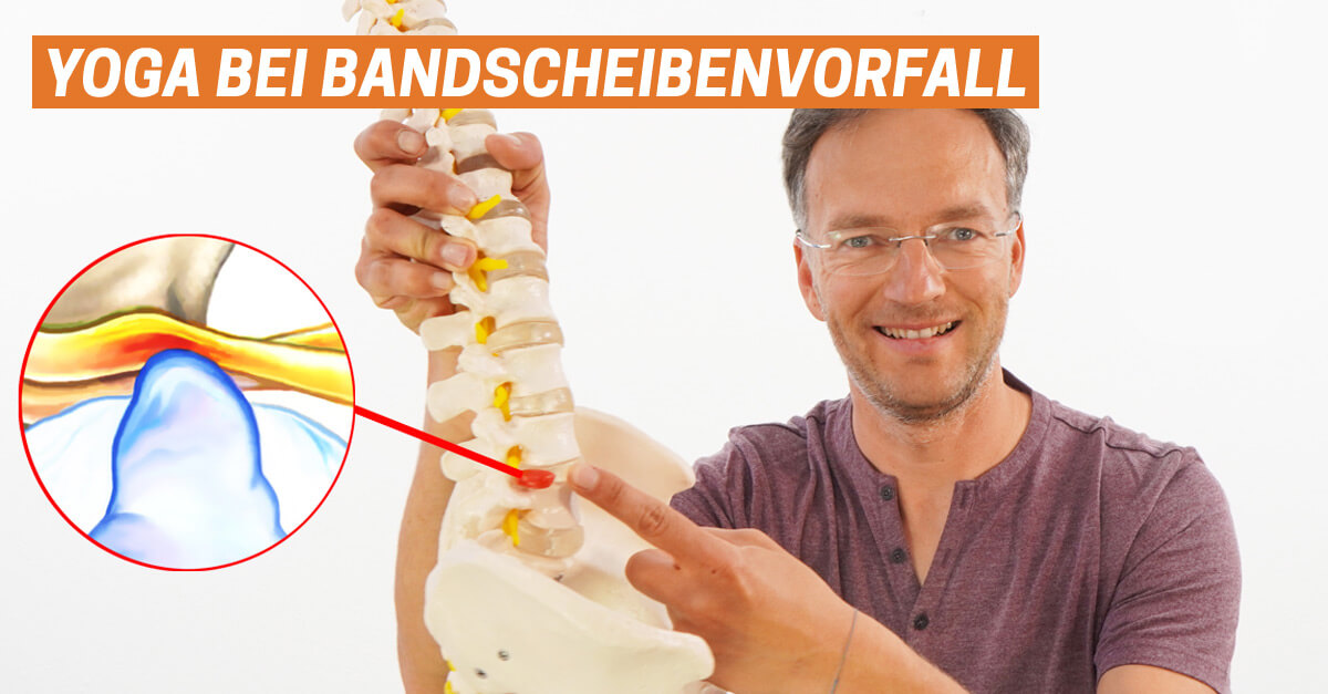 Yoga Bandscheibenvorfall